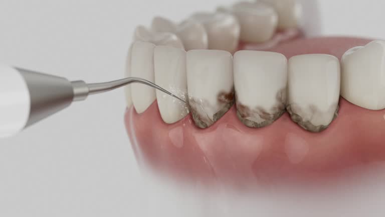 Reliable Dental Implants contractor in Holt, MI by Smile Center Dentistry